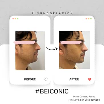 Slider image (4) ICONIC Medical Aesthetic